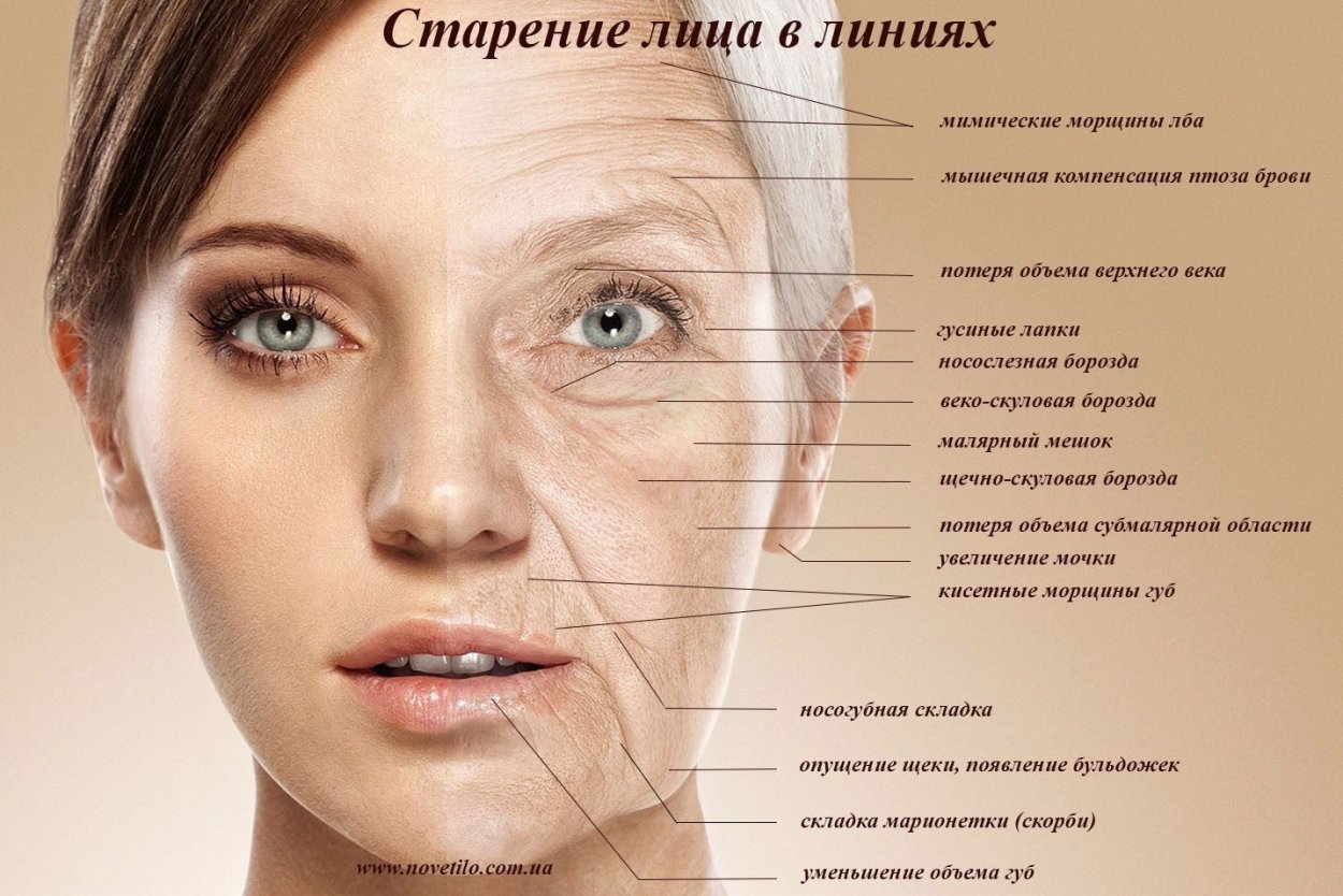 Морщины на лице названия