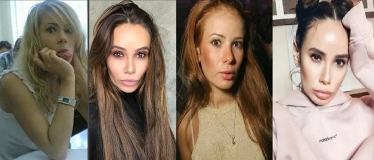 Айза Анохина до пластики