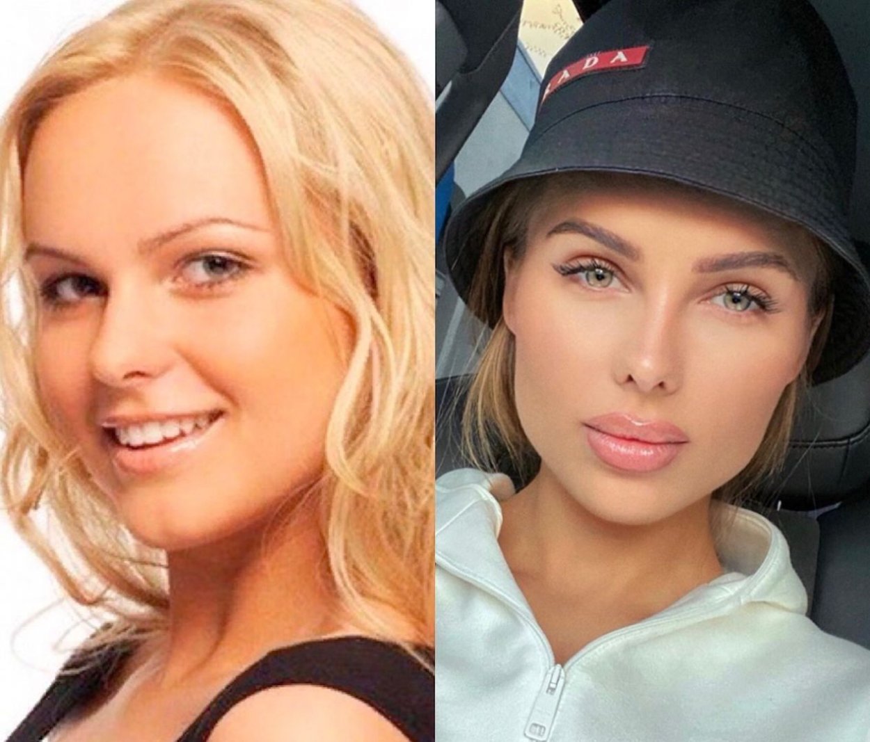 Анна Иванова Ханна до пластики