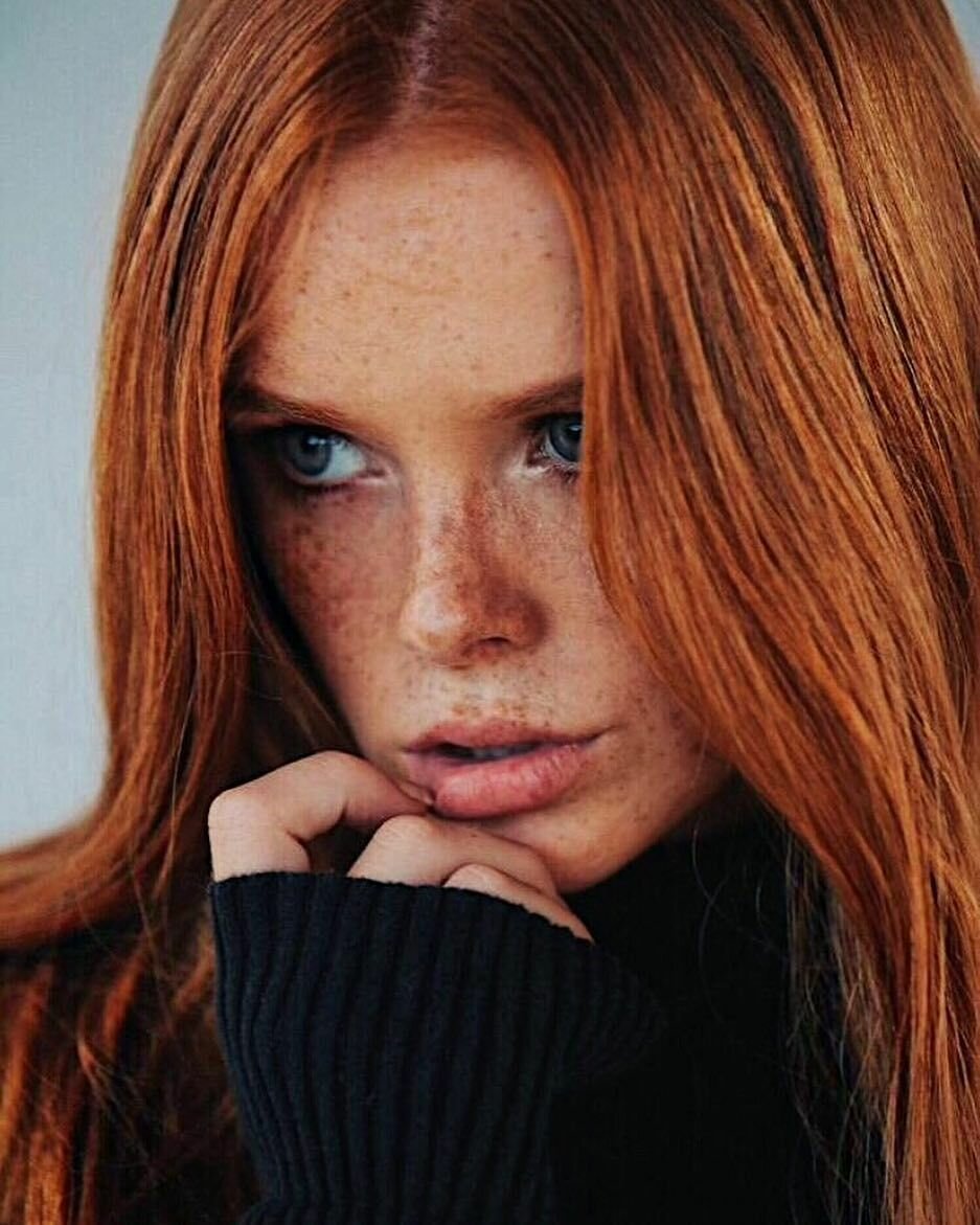 Freckled Girls Tumblr