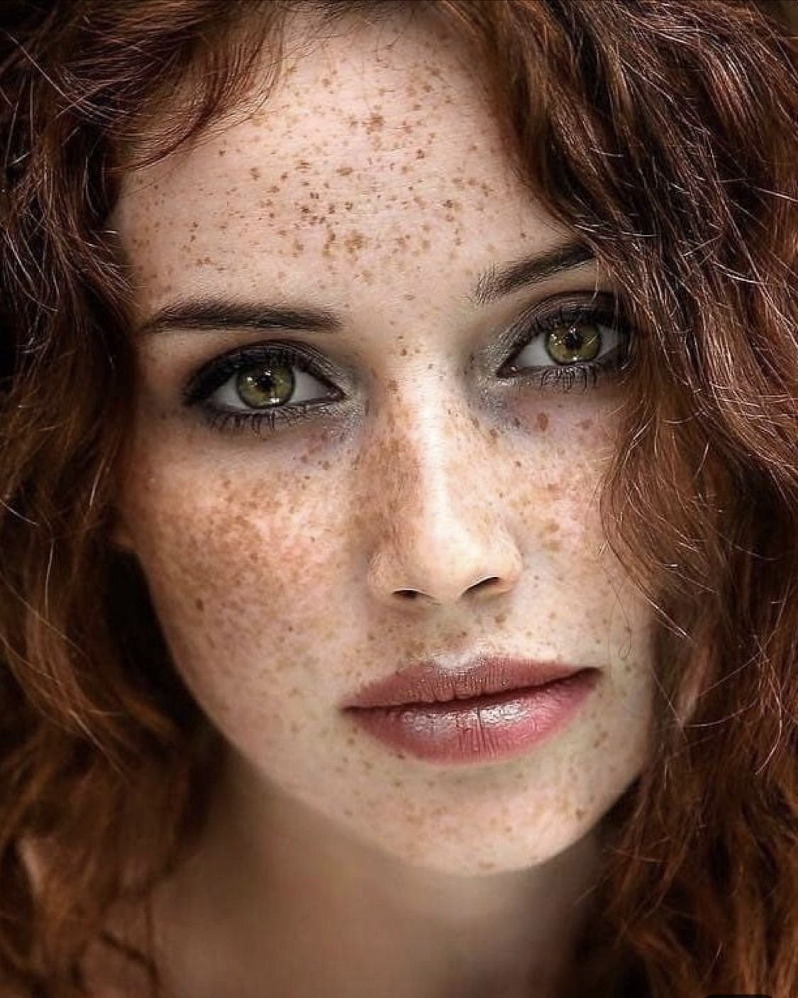 Hairy Freckles