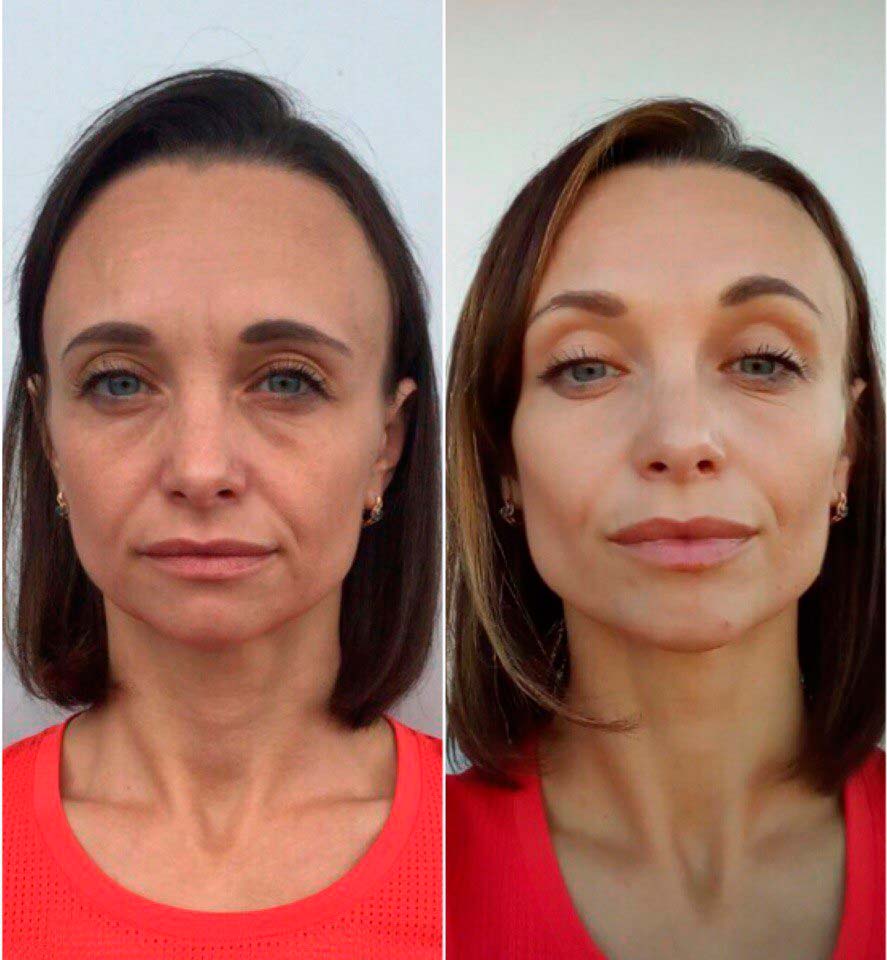 Массаж лица до и после