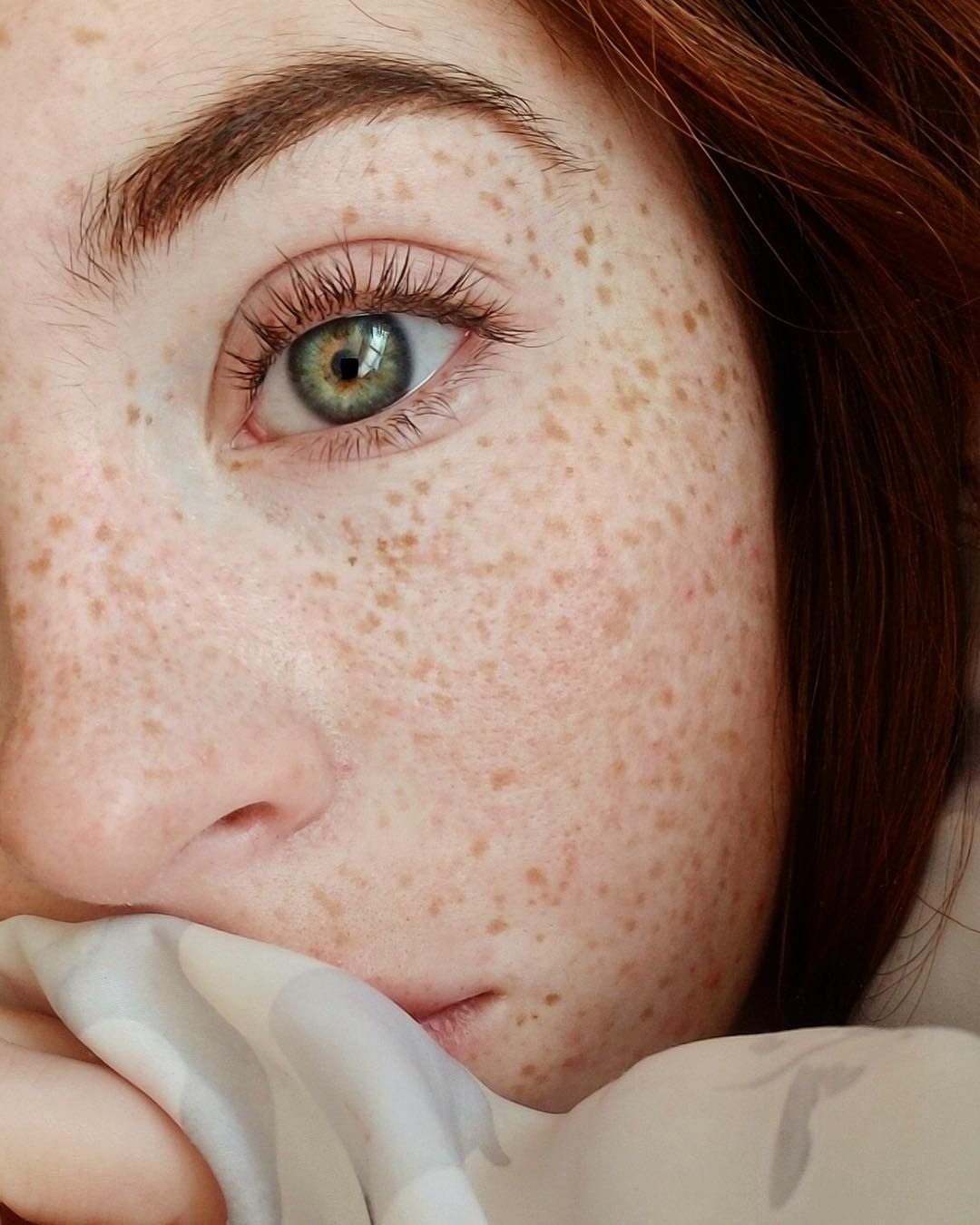 Freckled Tube