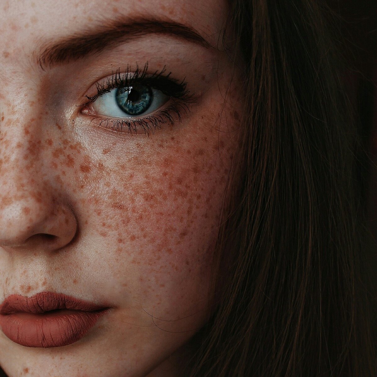 Teen With Freckles