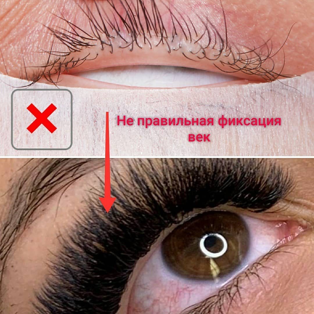 Плохо нарощенные ресницы