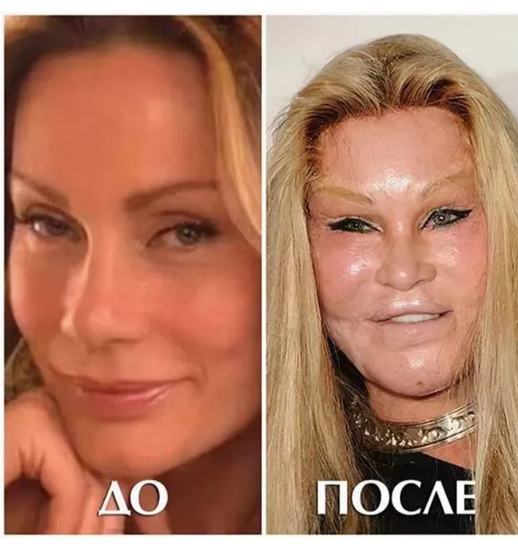 Supermaryface Plastic Surgery