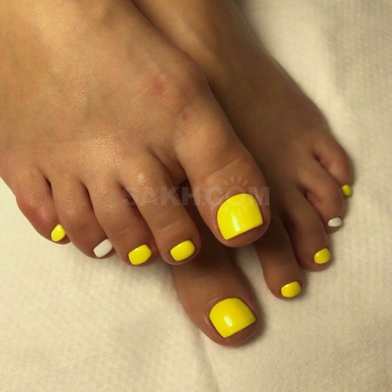 Желтые ногти на ногах