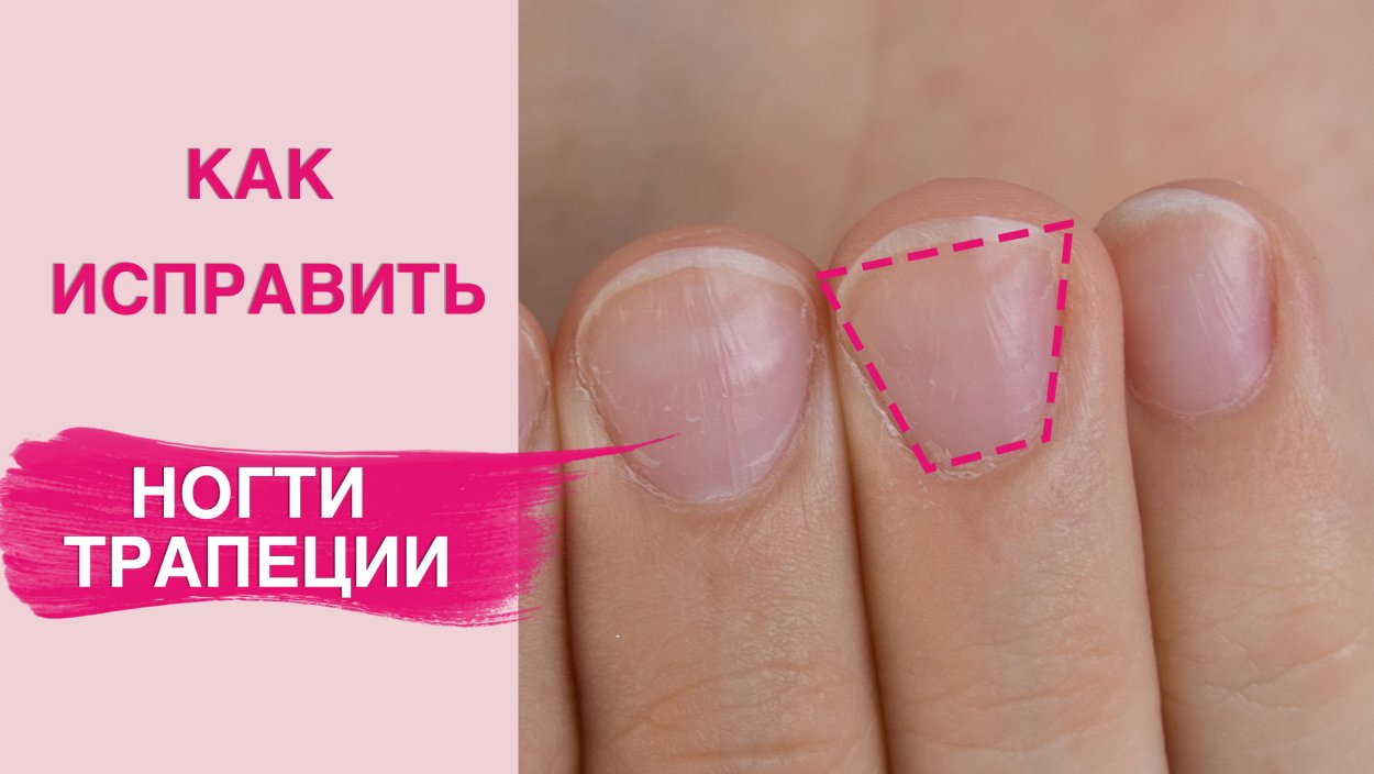 Маникюр на короткие ногти трапециевидной формы