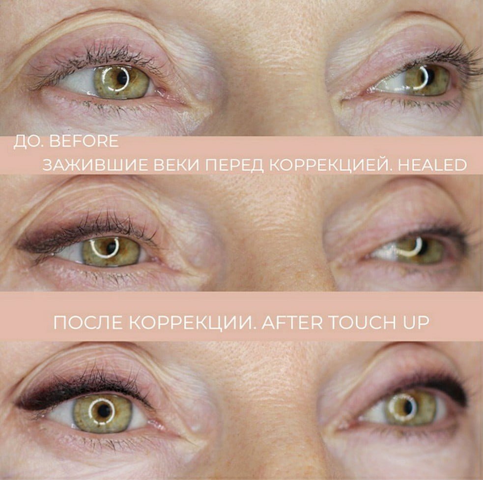 Процесс заживления перманента век