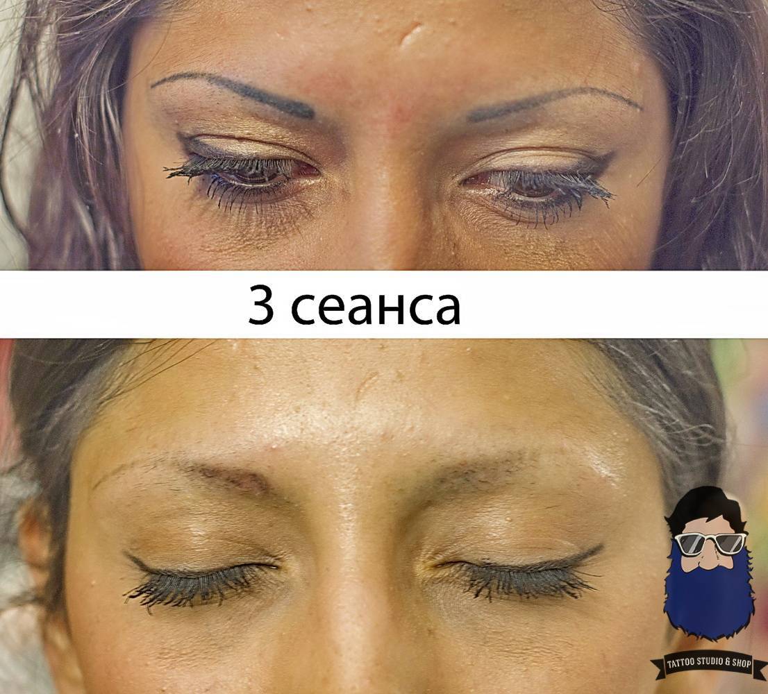 Татуаж бровей до и после
