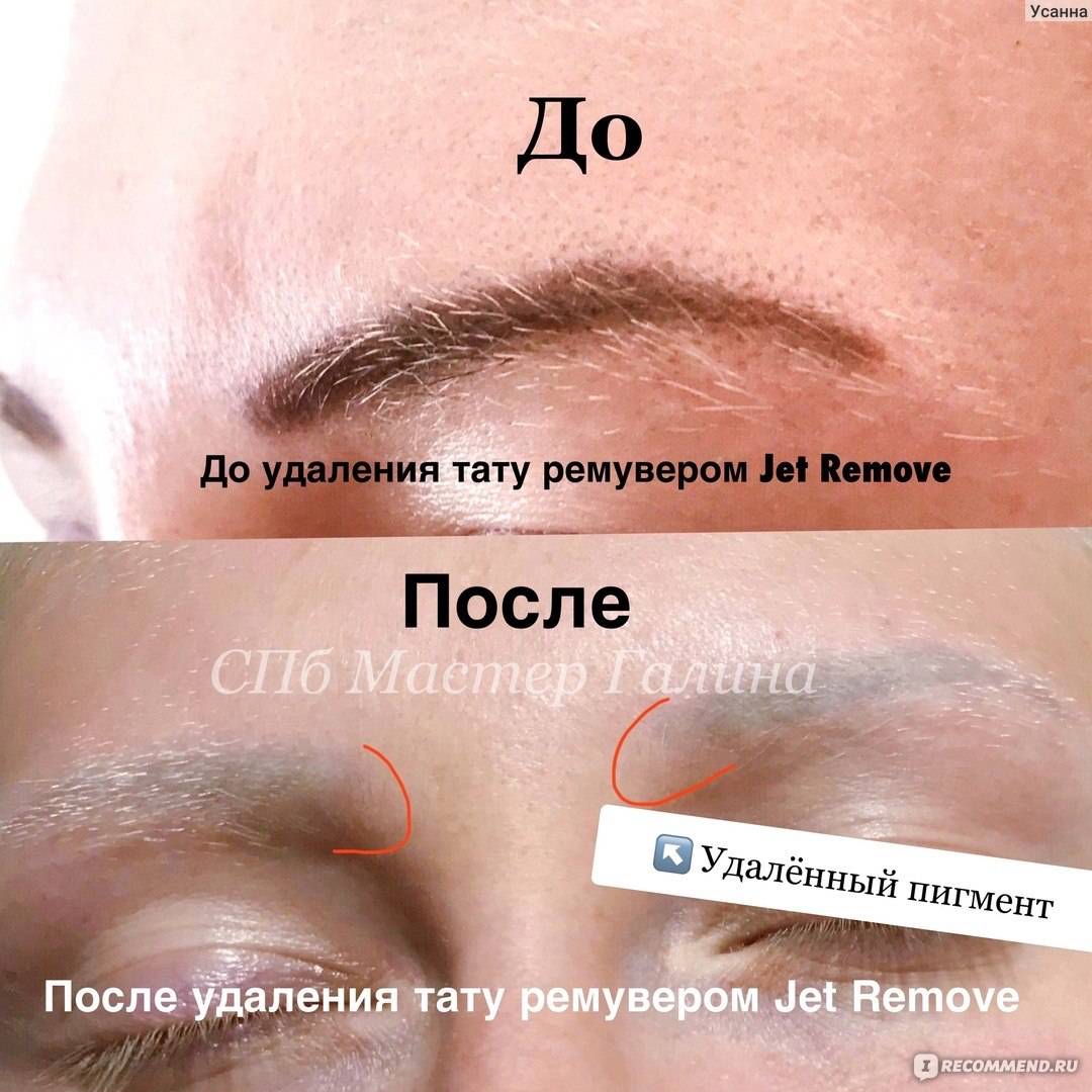 Ремувер до и после брови