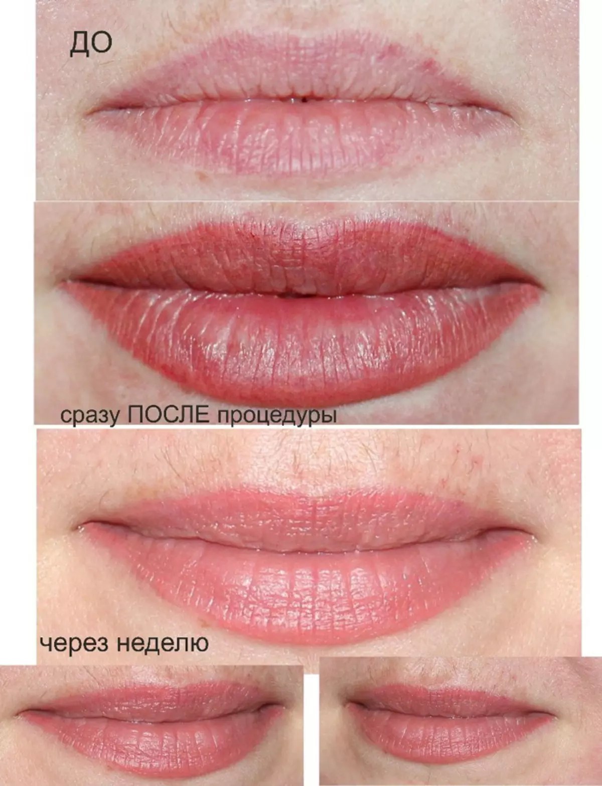 Перманентный макияж губ до и после