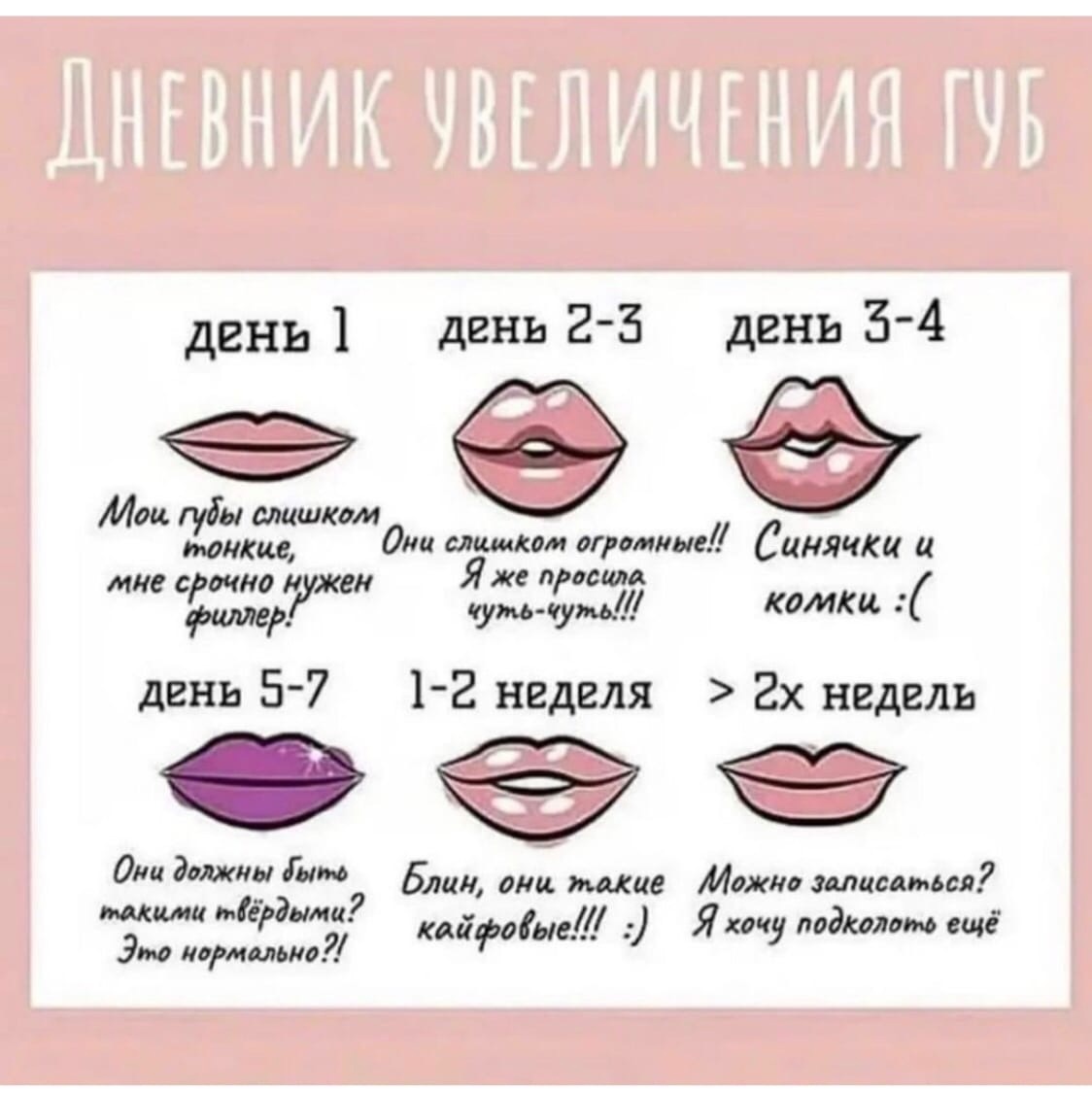 Форма губ для увеличения
