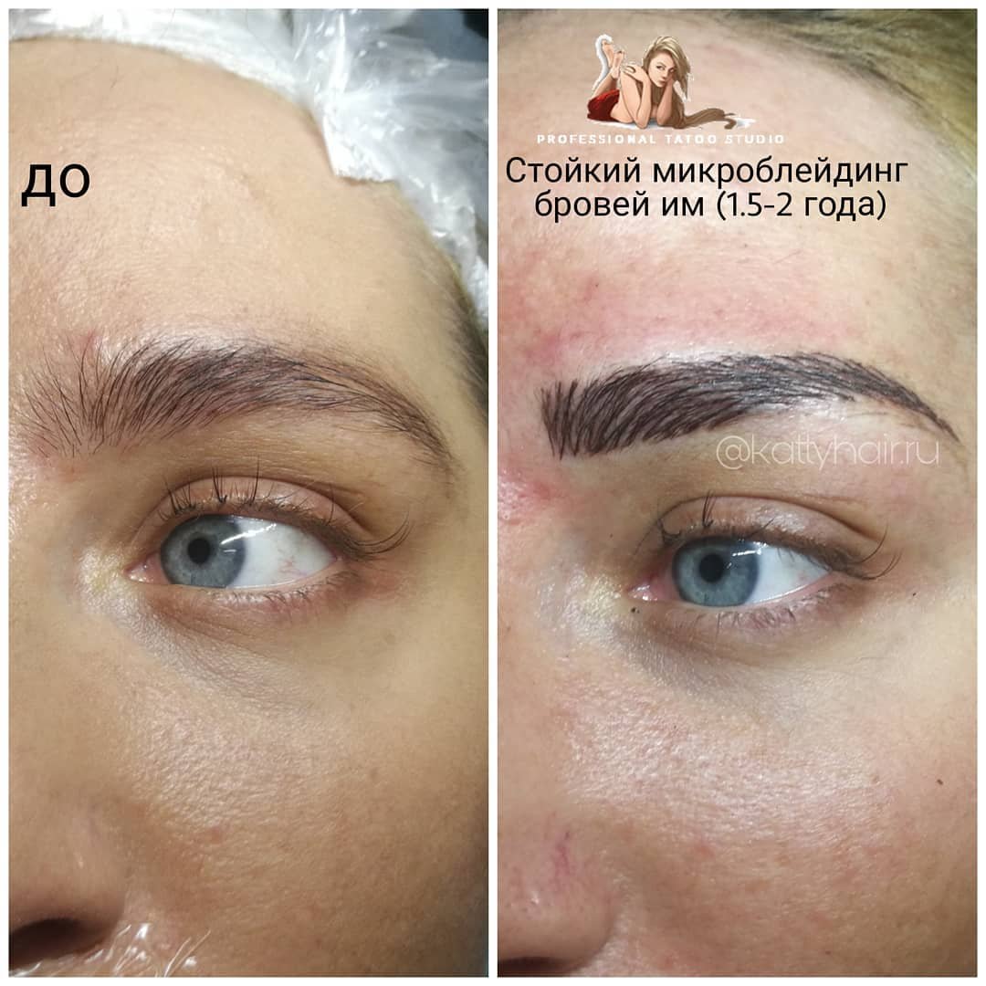 Заживление перманентного макияжа бровей