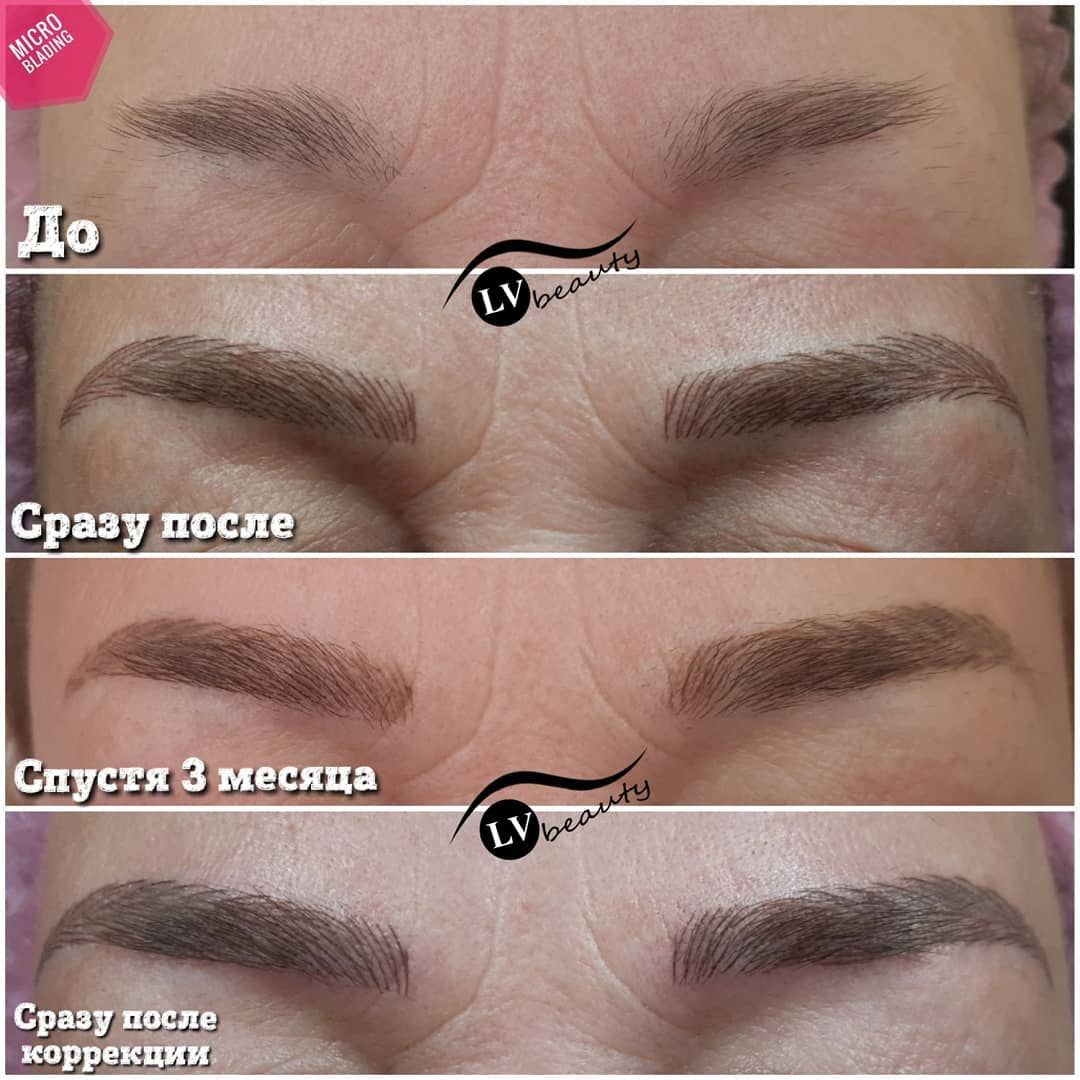 Заживление перманентного макияжа бровей