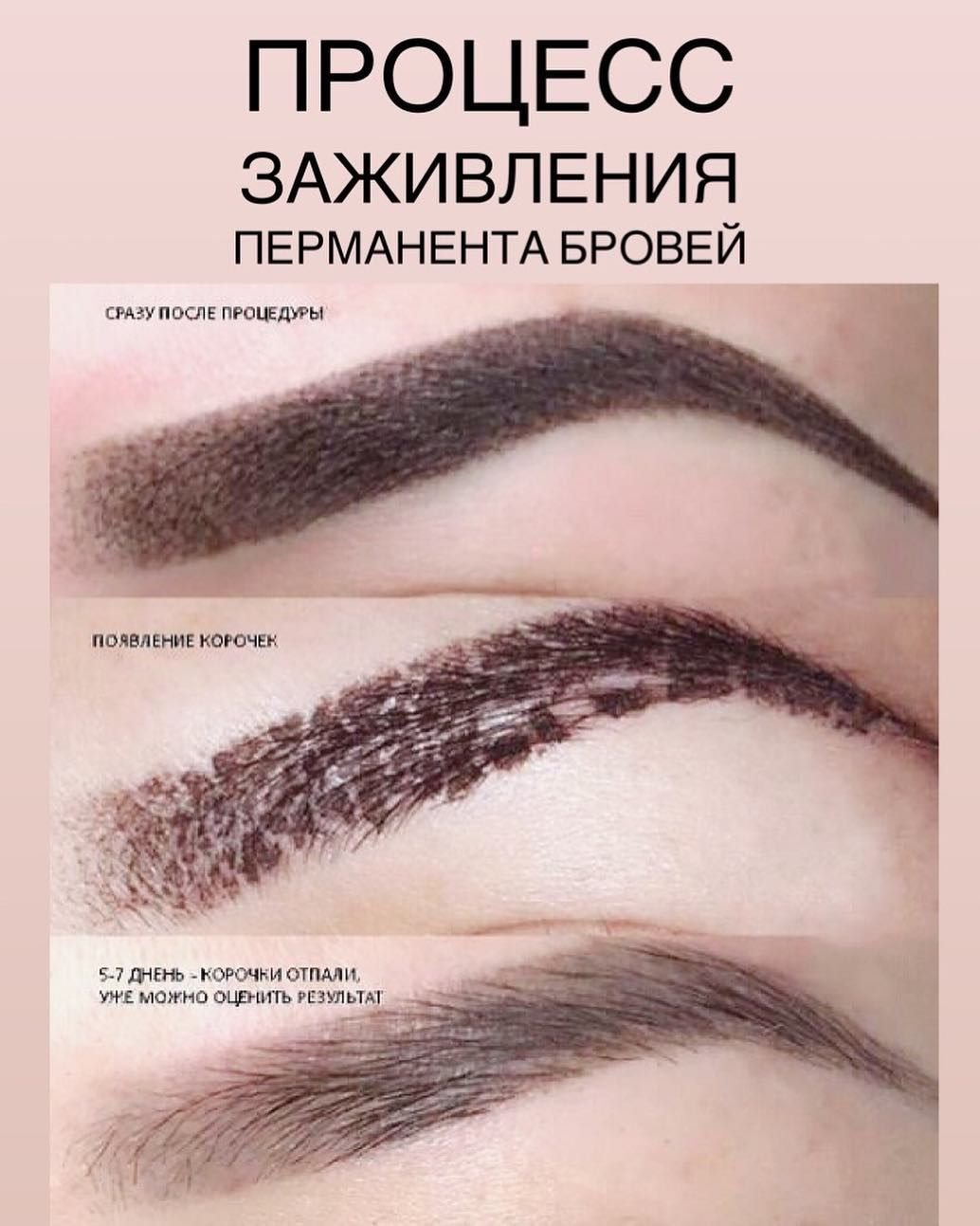 Процесс заживления ПМ бровей