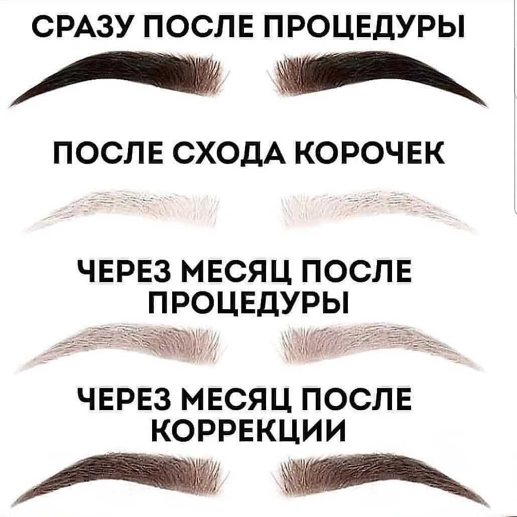 Процесс заживления ПМ