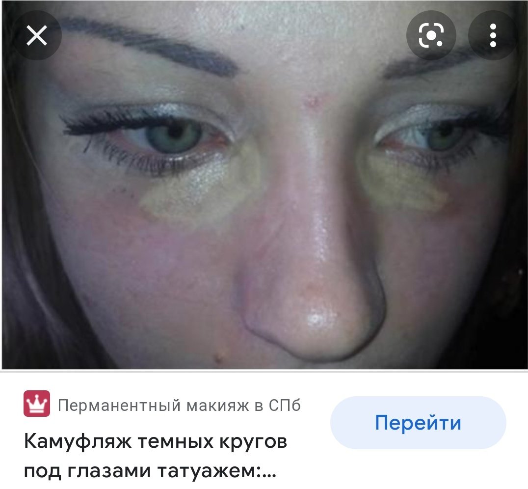 Неудачный перманентный макияж