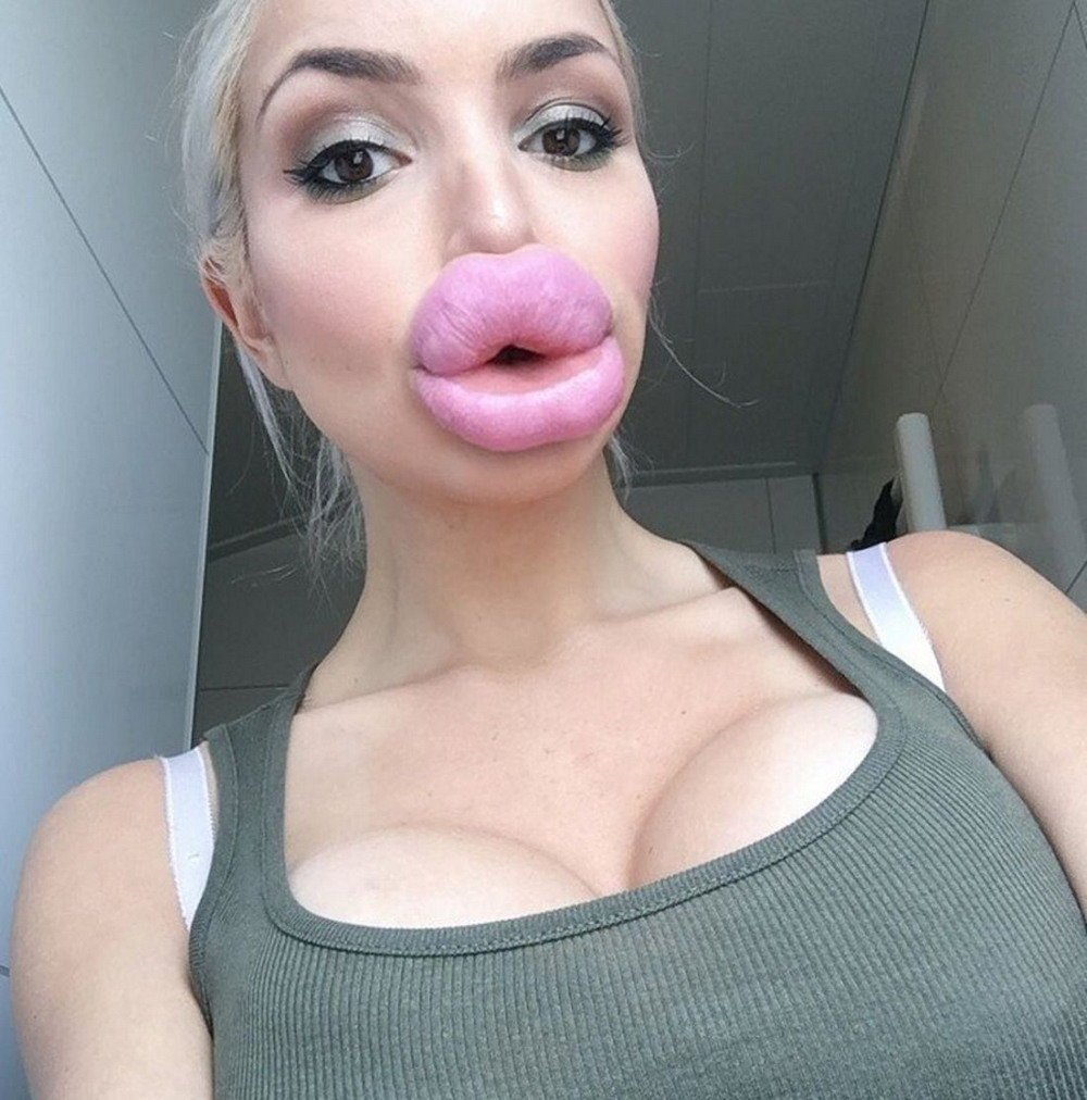 Силиконовые губы