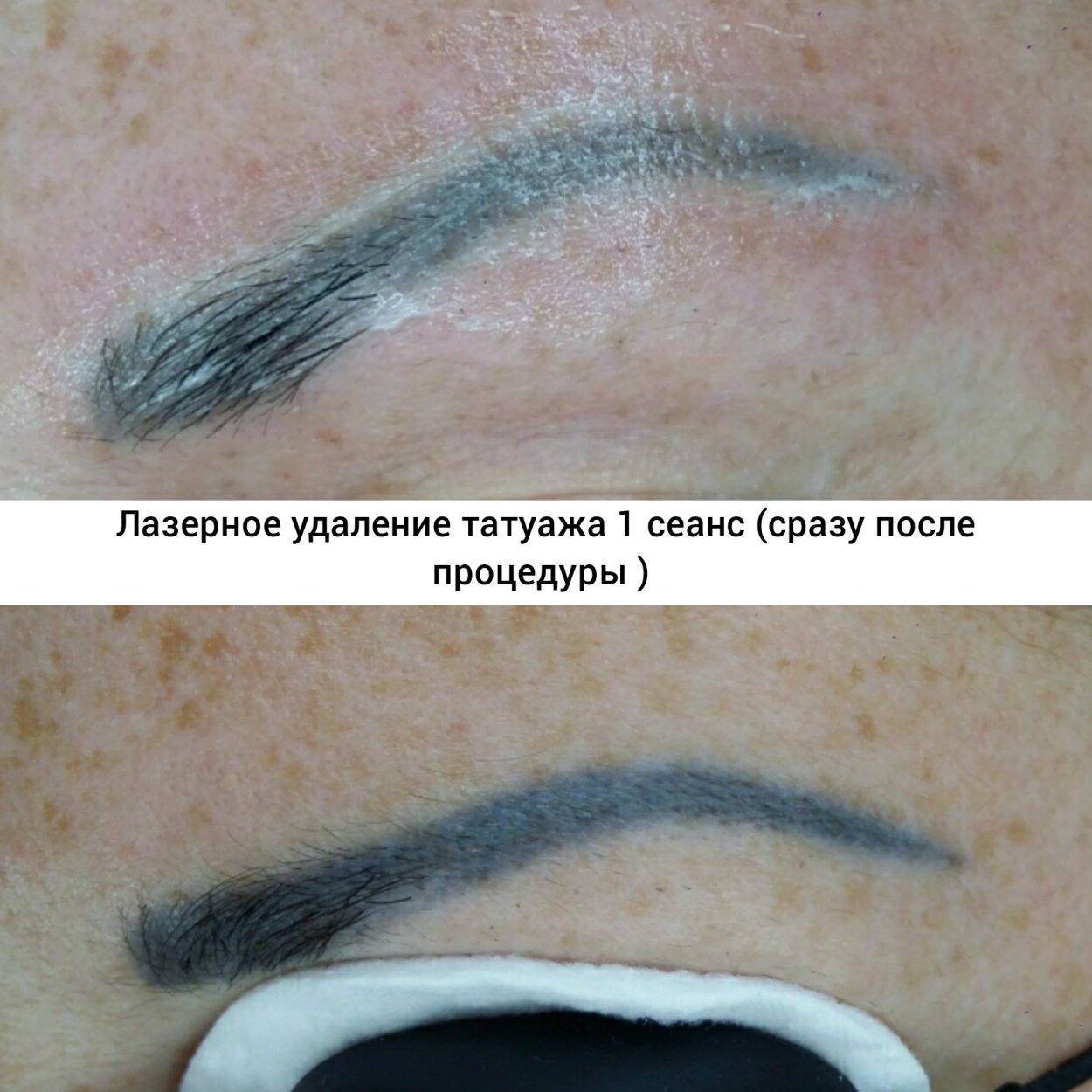 Татуаж после заживления