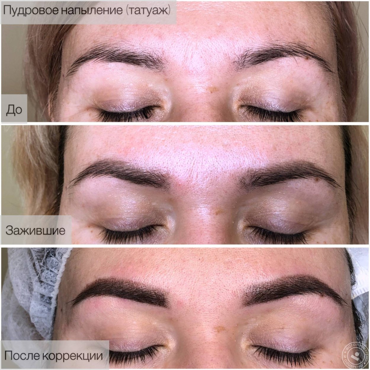 Татуаж бровей заживление