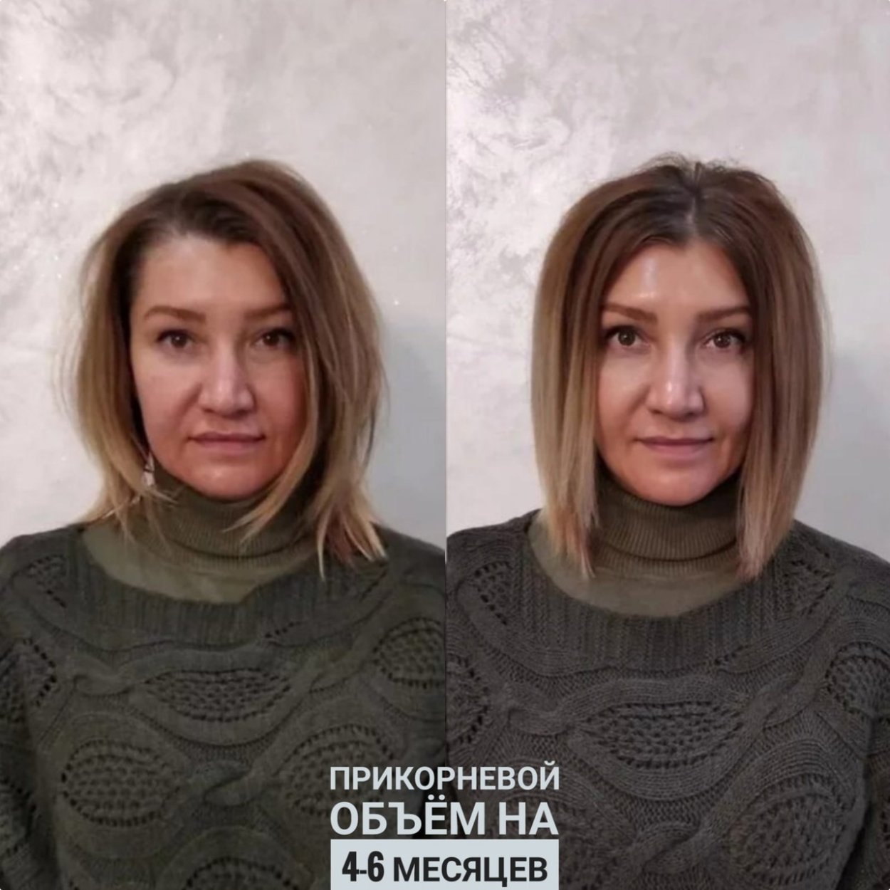 Гофре у корней